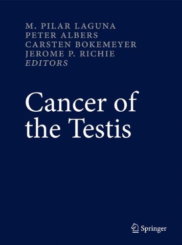 Cancer of the Testis von Springer